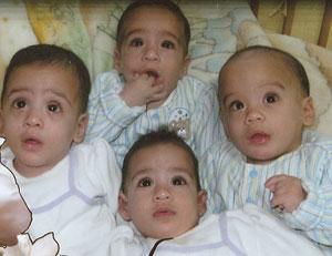 Quadruplets